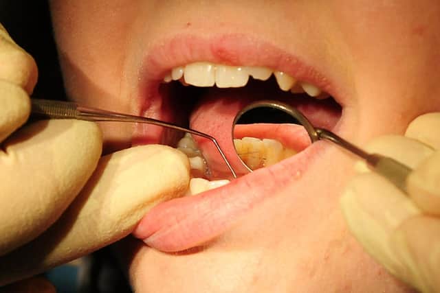 The British Dental Association said the country's oral health gap is widening yet ministers remain “asleep at the wheel”.