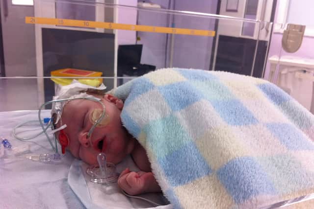 Baby Oliver undergoing care at Sheffield Children's Hospital.