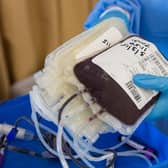 The NHS says more than 4,000 new blood donors are needed in Nottinghamshire, particularly people of black African and black Caribbean heritage