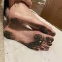 An image of Paula's mother's dirty feet while a resident at Forest Hill care home gained a lot of online attention. Credit: Paula Yarnall