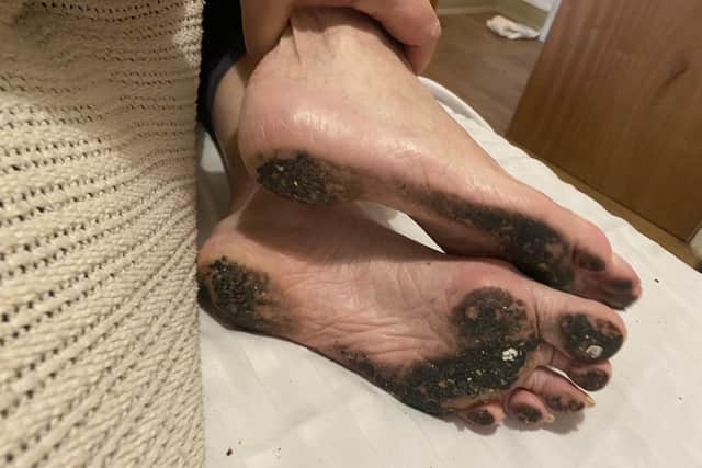 An image of Paula's mother's dirty feet while a resident at Forest Hill care home gained a lot of online attention. Credit: Paula Yarnall