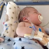 Oliver was transferred to Sheffield Children's at four days old.