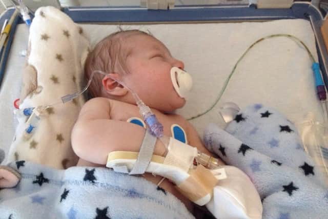 Oliver was transferred to Sheffield Children's at four days old.