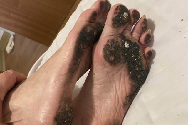 Paula Yarnall, daughter of a resident at the care home, found her mother's feet covered in dirt after visiting her in February. Credit: Paula Yarnall