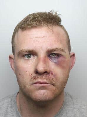 Pictured is Matthew Liversidge, aged 33, of Park View, Matlby, Rotherham, who was sentenced at Sheffield Crown Court to eleven years of custody with an extended two-and-a-half year custodial licence period due to him being deemed dangerous after he pleaded guilty to causing wounding with intent and to possessing an article with a blade or a point.

 

Matthew Liversidge was sentenced at Sheffield Crown Court to eleven years of custody with an extended two-and-a-half year licence period due to him being deemed dangerous and he must serve two-thirds of the eleven years before he can be considered for release.