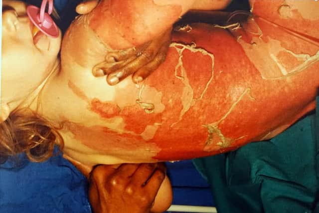 Roxy's organs began to shut down and her skin was hanging off after the accident