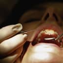 The state of dentistry in Nottinghamshire has been described as 'grim'.