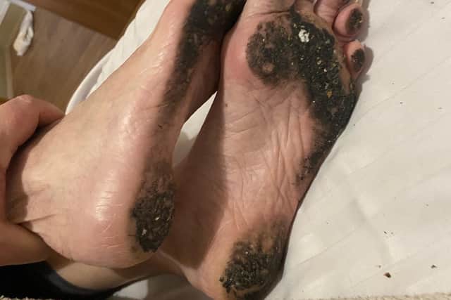 Anne's feet were found covered in dirt while she was in her bed at Forest Hill care home in February. Credit: Paula Yarnall