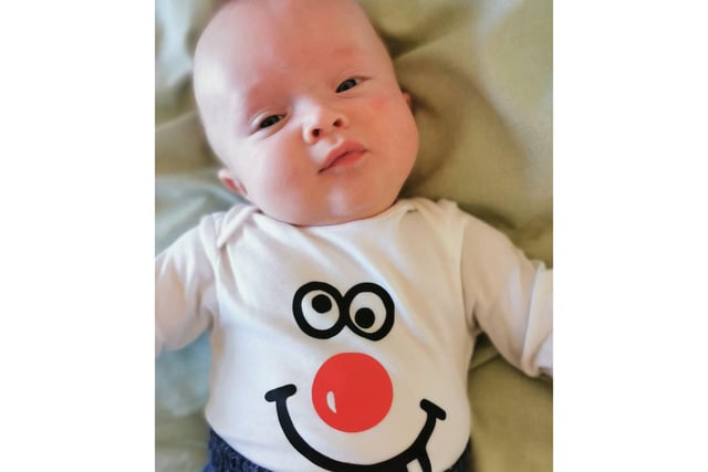 Look at that face! Baby Rudi Davis dressed up for his first Red Nose Day at just four-months old.