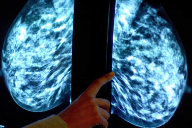 More cancer cases are only being discovered after emergency hospital admissions. Photo: PA/Rui Vieira