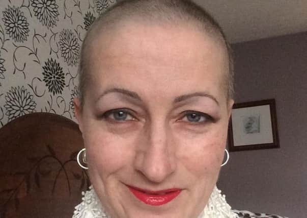 Little hair but still plenty of lipstick for Sue after her chemotherapy treatment. She says losing her eyelashes was the worst bit and had eyebrows tattooed on before treatment.