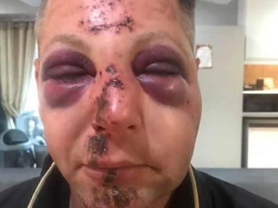 Police are appealing for information after a man was beaten up in Hucknall on Saturday.
