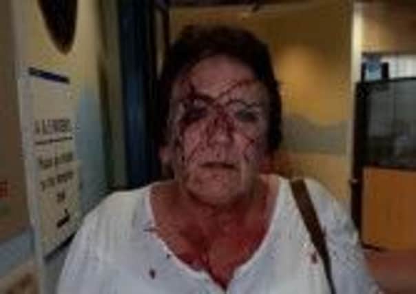 A 58-year-old woman who was assaulted in Maltby