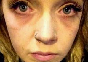 Melissa took this photo after the gas released during the attack made her eyes burn
