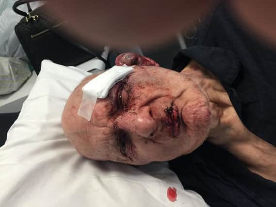 Mansfield pensioner Cyril Smith was seriously injured in an incident at the Parkside nursing home.