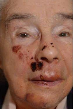 Kathleen Cordon aged 82 was attacked and robbed in Gainsborough